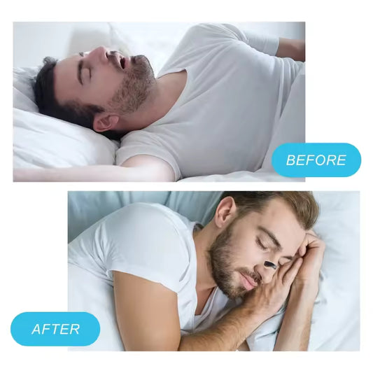 Anti-Snore Breathing Clip — Sleep Better Tonight